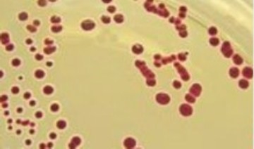 硅酸盐细菌培养基(上海)