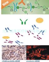 幽门螺杆菌抗体(IgG\IgM)价格 含量99