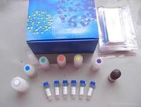 人Ⅰ型前胶原羧基端肽(PⅠCP)ELISA Kit